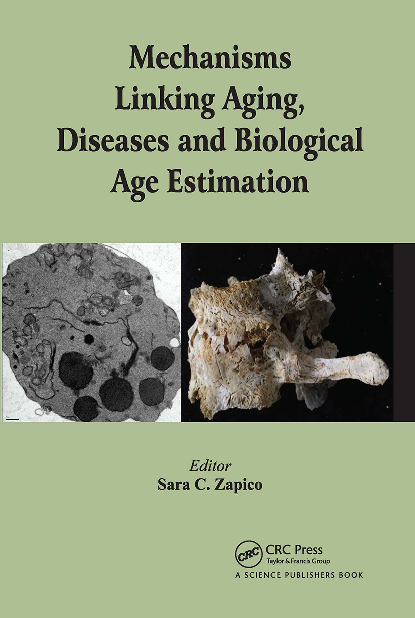 【预订】Mechanisms Linking Aging, Diseases and Biological Age Estimation 9780367782429 书籍/杂志/报纸 人文社科类原版书 原图主图