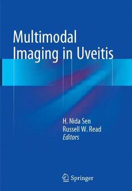 预订 Multimodal Imaging in Uveitis