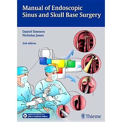 预订 Manual of Endoscopic Sinus and Skull Base Surgery 内镜鼻窦手册和颅底手术: 9783131309723