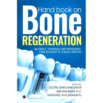 预订 Hand book on Bone regeneration: Materials, Techniques and Procedures: From Research to Clinical Practice: 978164587
