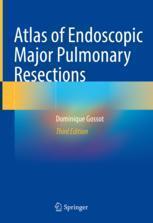 [预订]Atlas of Endoscopic Major Pulmonary Resections 9783030741143
