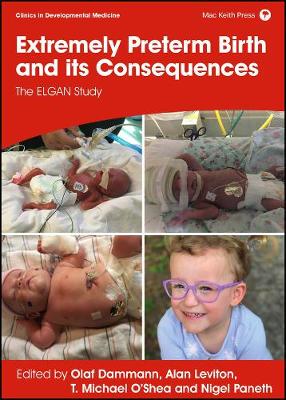 【预订】Extremely Preterm Birth And Its Consequences - The Elgan Study