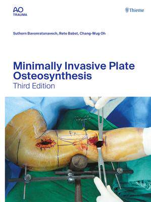 [预订]Minimally Invasive Plate Osteosynthesis 9783132454255