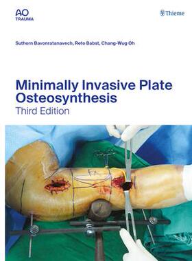 [预订]Minimally Invasive Plate Osteosynthesis 9783132454255
