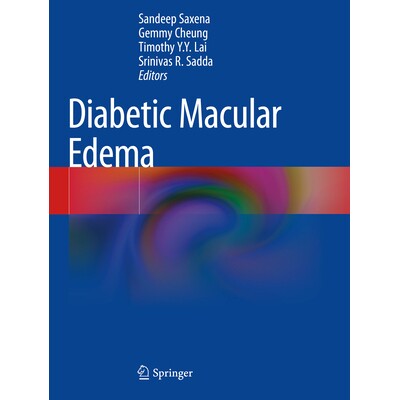 预订 Diabetic Macular Edema 糖尿病性黄斑水肿 9789811973093