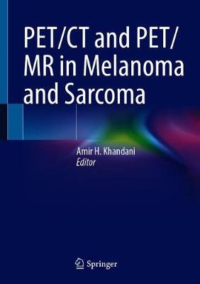 【预订】PET/CT and PET/MR in Melanoma and Sarcoma