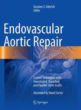 【预订】Endovascular Aortic Repair 9783319792149