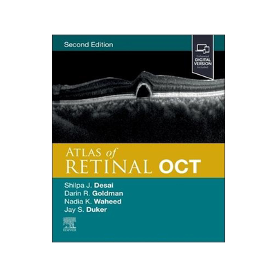 [预订]Atlas of Retinal Oct 9780323930437