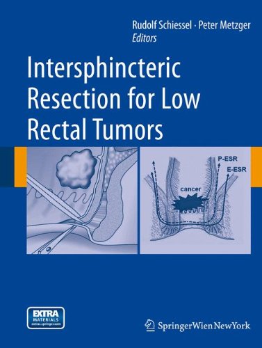 【预订】Intersphincteric Resection for Low Rectal Tumors