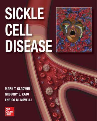 [预订]Sickle Cell Disease 9781260458596