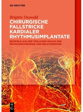 预订 Chirurgische Fallstricke kardialer Rhythmusimplantate: Beispiele aus der täglichen Praxis der Revisionschirurgie u