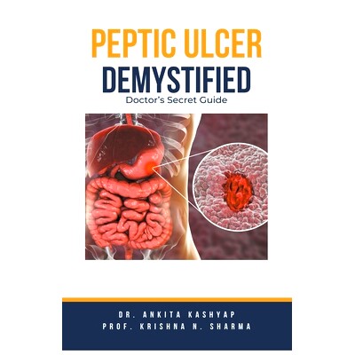 预订 Peptic Ulcer Demystified: Doctor's Secret Guide