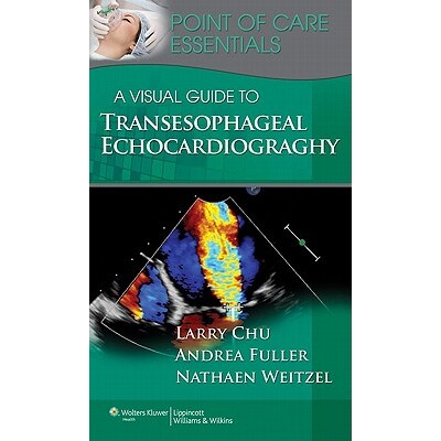 预订 A Visual Guide to Transesophageal Echocardiography (Point of Care Essentials) 经食道超声心动图的视觉指南 9781451127