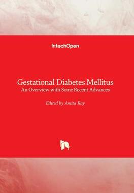 [预订]Gestational Diabetes Mellitus - An Overview with Some Recent Advances 9781789847338
