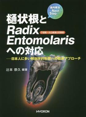 [预订]樋状根とRadix Entomolarisへの対応 日本人に多い解剖学的形態への臨床アプロ 9784864320764
