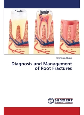 预订 Diagnosis and Management of Root Fractures: 9786139995684