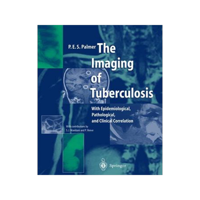 预订 The Imaging of Tuberculosis
