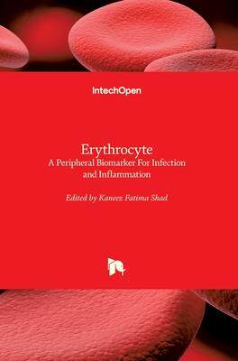 [预订]Erythrocyte: A Peripheral Biomarker For Infection and Inflammation 9781839691201