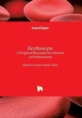 [预订]Erythrocyte: A Peripheral Biomarker For Infection and Inflammation 9781839691201