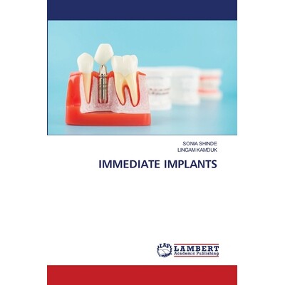 预订 Immediate Implants 9786205513620