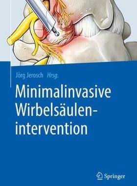 预订 Minimalinvasive Wirbelsäulenintervention