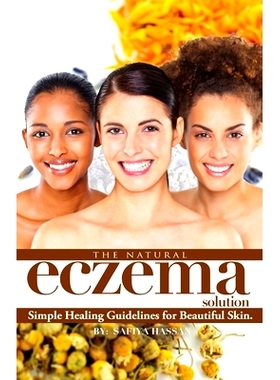 预订 The Natural Eczema Solution: Simple Healing Guidelines for Beautiful Skin.: 9780692761342
