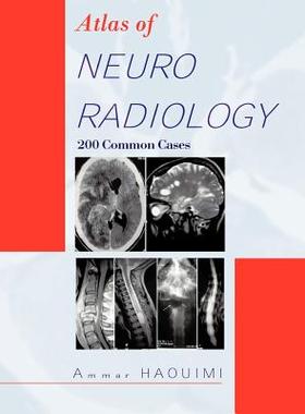 预订 Atlas of Neuroradiology: 200 Common Cases