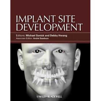 【预订】Implant Site Development