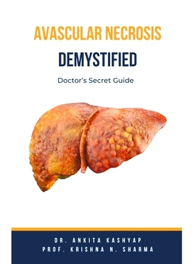 预订 Avascular Necrosis Demystified: Doctor's Secret Guide