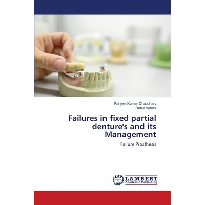 预订 Failures in fixed partial denture’s and its Management 固定局部义齿的失效及处理: 9786202800655