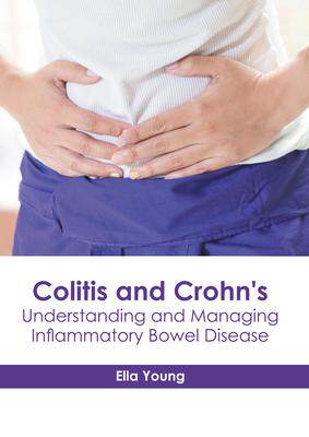 [预订]Colitis and Crohn’s: Understanding and Managing Inflammatory Bowel Disease 9781632419118