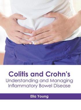 [预订]Colitis and Crohn’s: Understanding and Managing Inflammatory Bowel Disease 9781632419118