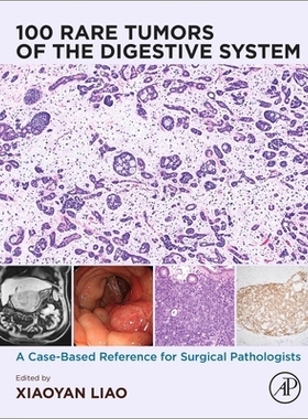 预订 100 Rare Tumors of the Digestive System: A Case-Based Reference for Surgical Pathologists 100种罕见消化系统肿瘤：外