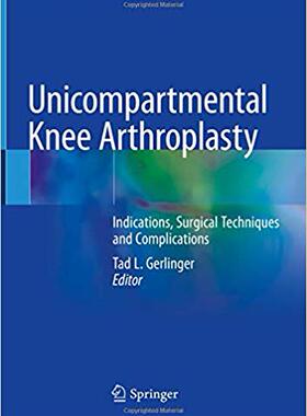 【预订】Unicompartmental Knee Arthroplasty