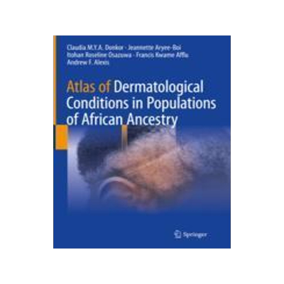 [预订]Atlas of Dermatological Conditions in Populations of African Ancestry 9783030726164