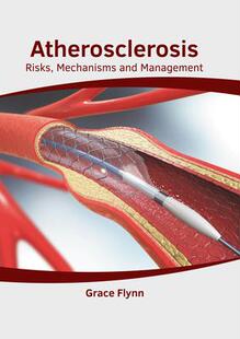 Risks Atherosclerosis 预订 9781632429681 and Management Mechanisms