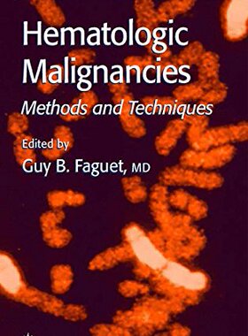 【预订】Hematologic Malignancies