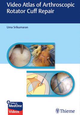 [预订]Video Atlas of Arthroscopic Rotator Cuff Repair 9781626237124