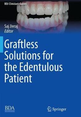 【预订】Graftless Solutions for the Edentulous Patient