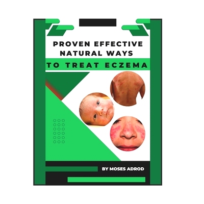 预订 Proven Effective Natural Ways to Treat Eczema: 9798379010058