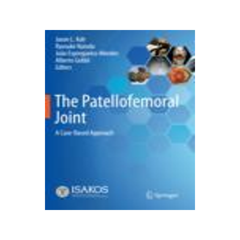 [预订]The Patellofemoral Joint