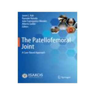 [预订]The Patellofemoral Joint