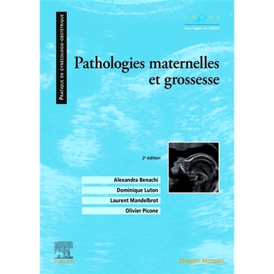 预订 Pathologies maternelles et grossesse 孕产妇病理和妊娠: 9782294773518