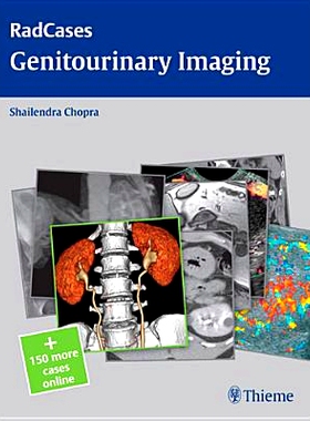 预订 Radcases Genitourinary Imaging 泌尿生殖系统影像学: 9781604063240