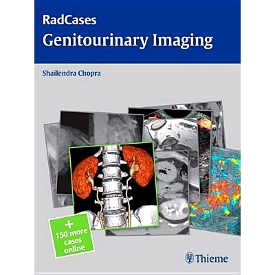 预订 Radcases Genitourinary Imaging 泌尿生殖系统影像学: 9781604063240