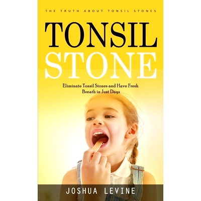 预订 Tonsil Stones: The Truth about Tonsil Stones (Eliminate Tonsil Stones and Have Fresh Breath in Just Days!)