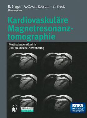 预订 Kardiovaskuläre Magnetresonanztomographie