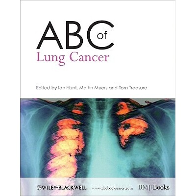 预订 Abc Of Lung Cancer 肺癌基本知识: 9781405146524