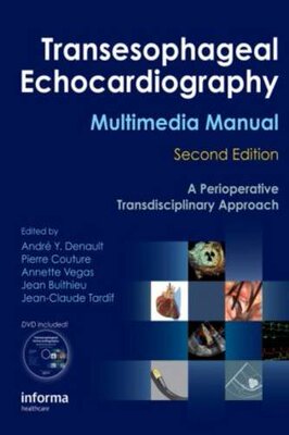 【预订】Transesophageal Echocardiography Multimedia Manual