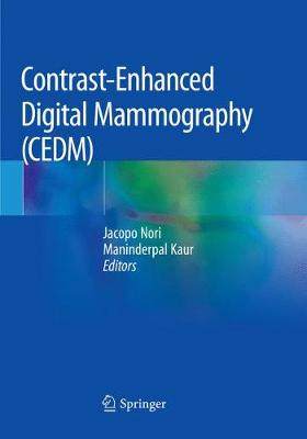 预订 Contrast-Enhanced Digital Mammography (CEDM)